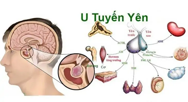 Thực phẩm kích thích tuyến yên không cần tìm đâu xa, ở ngay trong tủ lạnh nhà bạn