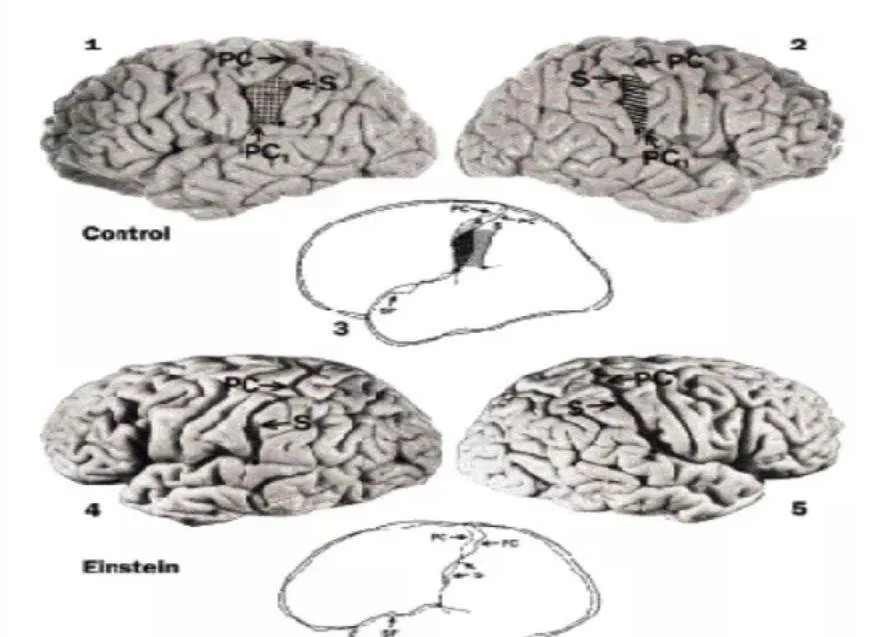 Einstein đã nói 2 từ trước khi chết, nhưng y tá không hiểu, và não của ông bị cắt thành 240 mảnh sau khi chết. Hai từ đó là gì?