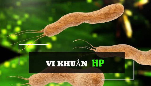 Diệt vi khuẩn H.P phòng ung thư dạ dày cần thiết hay không?