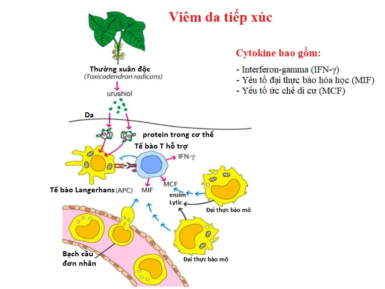 Tại sao cây thường xuân độc gây phát ban?