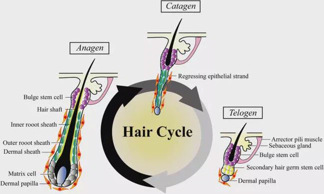 Lí giải về hiện tượng tóc bạc trắng sau 1 đêm