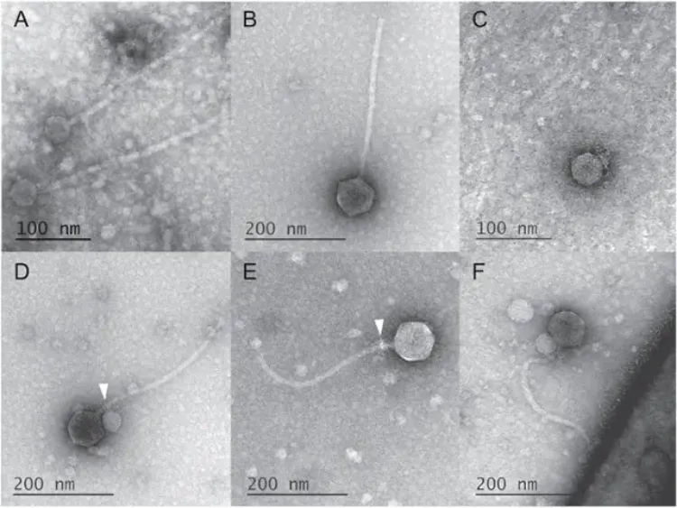 Các nhà khoa học không thể tin được! Virus ma cà rồng lần đầu tiên được phát hiện ở Mỹ