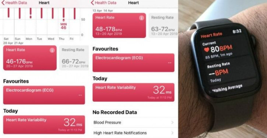Phải chăng smartwatch và vòng tay thông minh đang khiến chúng ta lo lắng về sức khỏe không cần thiết? Phải chăng smartwatch và vòng tay thông minh đang khiến chúng ta lo lắng về sức khỏe không cần thiết?