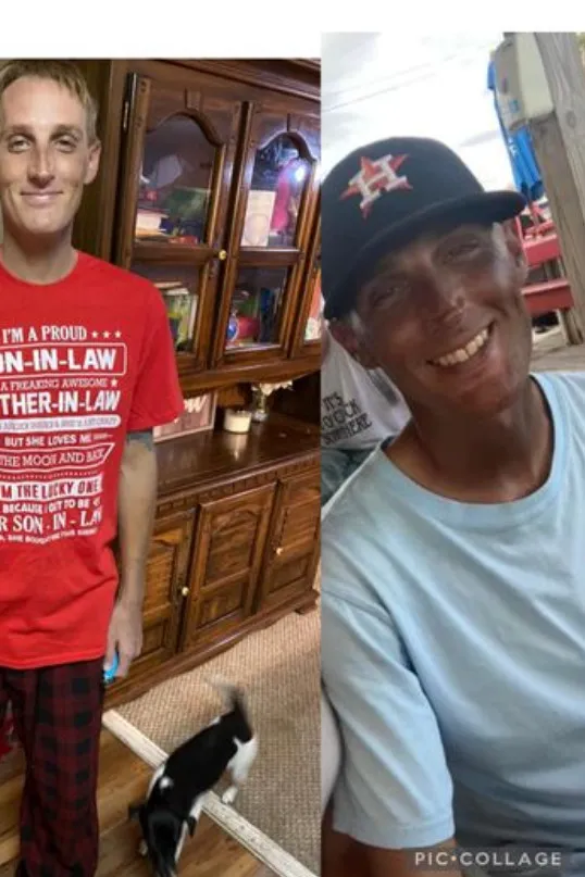 Người đàn ông bị đổi màu da từ trắng sang nâu không rõ nguyên nhân sau khi uống thuốc chống trầm cảm Người đàn ông bị đổi màu da từ trắng sang nâu không rõ nguyên nhân sau khi uống thuốc chống trầm cảm