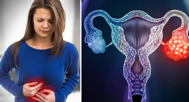 Một xét nghiệm duy nhất có thể dự đoán nguy cơ mắc 4 bệnh ung thư ở phụ nữ Một xét nghiệm duy nhất có thể dự đoán nguy cơ mắc 4 bệnh ung thư ở phụ nữ