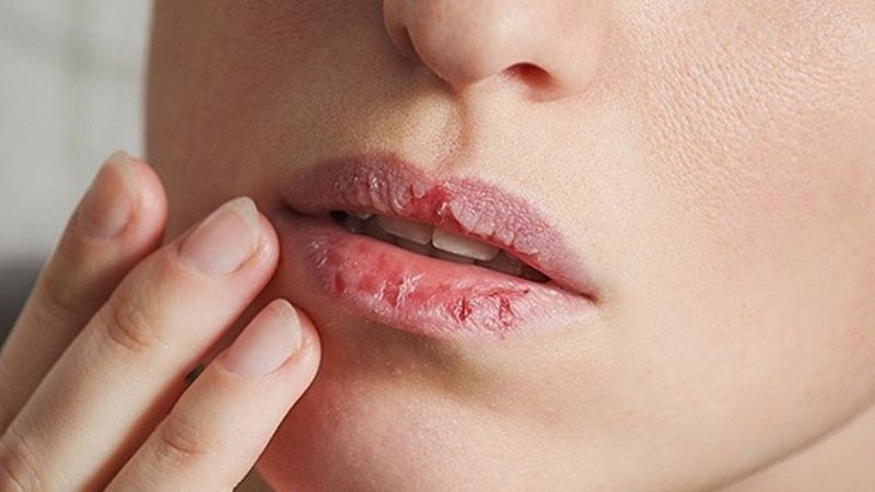Nóng trong người nên uống gì để giải nhiệt? Những thức uống thanh mát giúp bạn giải nhiệt cơ thể Nóng trong người nên uống gì để giải nhiệt? Những thức uống thanh mát giúp bạn giải nhiệt cơ thể