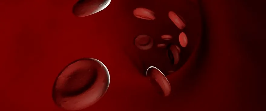 Nếu bạn hay  bị chảy máu và bầm tím, hãy cảnh giác, nó có thể là biểu hiện của ung thư Nếu bạn hay  bị chảy máu và bầm tím, hãy cảnh giác, nó có thể là biểu hiện của ung thư