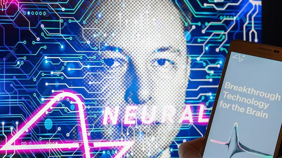 Thần giao cách cảm của Elon Musk đã có thể điều khiển bằng suy nghĩ Thần giao cách cảm của Elon Musk đã có thể điều khiển bằng suy nghĩ