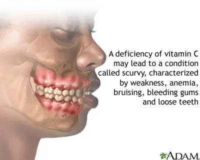 Vitamin C có tác dụng gì? Cần hấp thu bao nhiêu vitamin C mỗi ngày? Vitamin C có tác dụng gì? Cần hấp thu bao nhiêu vitamin C mỗi ngày?