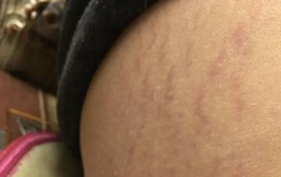 Phụ nữ đã phá thai và chưa phá thai khác nhau ở 3 bộ phận này, không thể giấu được Phụ nữ đã phá thai và chưa phá thai khác nhau ở 3 bộ phận này, không thể giấu được