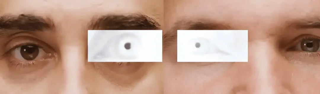 Dù iPhone có Face ID, người ta vẫn chọn Google Pixel 4 để nghiên cứu bệnh Alzheimer Dù iPhone có Face ID, người ta vẫn chọn Google Pixel 4 để nghiên cứu bệnh Alzheimer