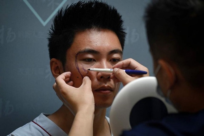 Tưởng chỉ trai Hàn mới thích phẫu thuật thẩm mỹ nào ngờ trai Trung cũng nghiện dao kéo nặng Tưởng chỉ trai Hàn mới thích phẫu thuật thẩm mỹ nào ngờ trai Trung cũng nghiện dao kéo nặng